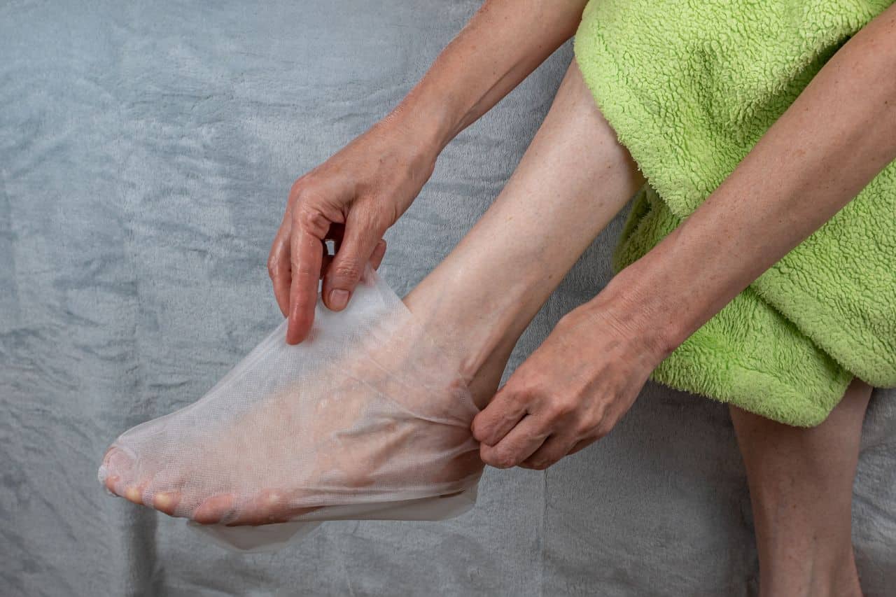 peeling pied
